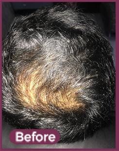 PRP Before
